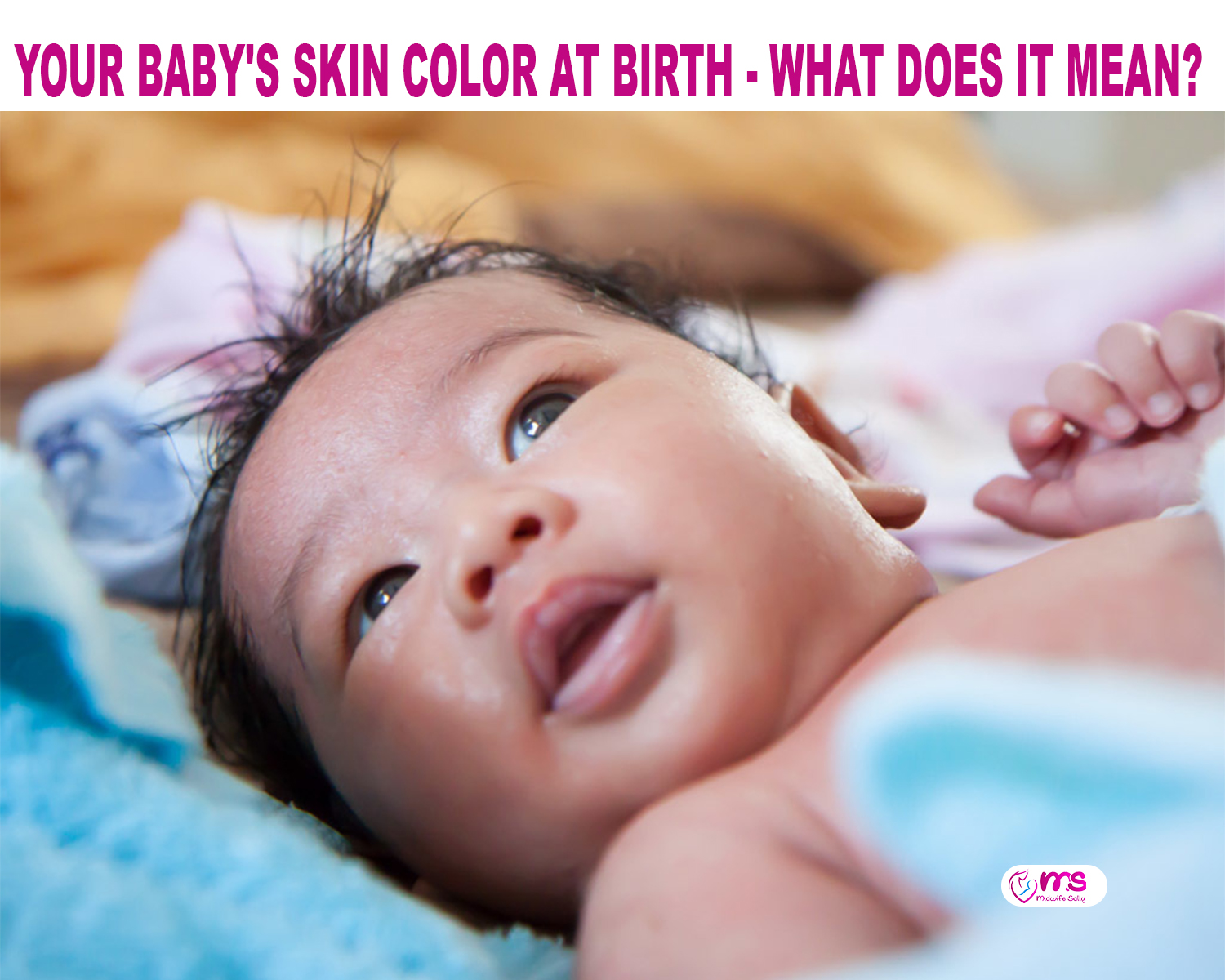 Baby Skin Colour