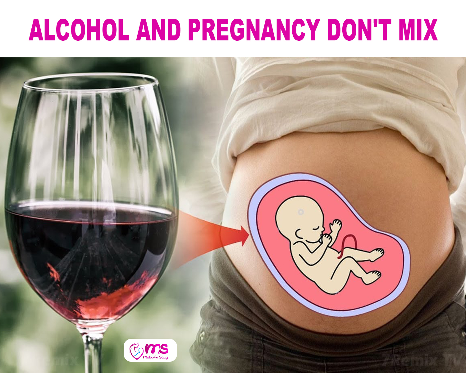 Pregnancy and Alcohol