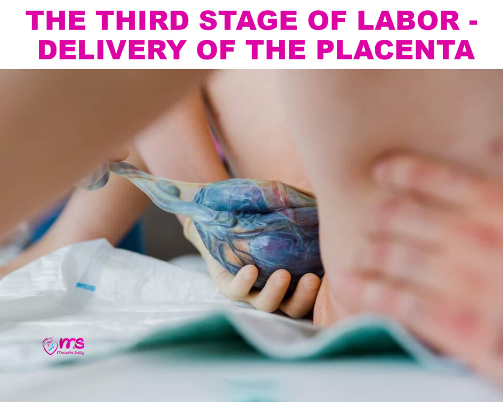 THE THIRD STAGE OF LABOR – DELIVERY OF THE PLACENTA