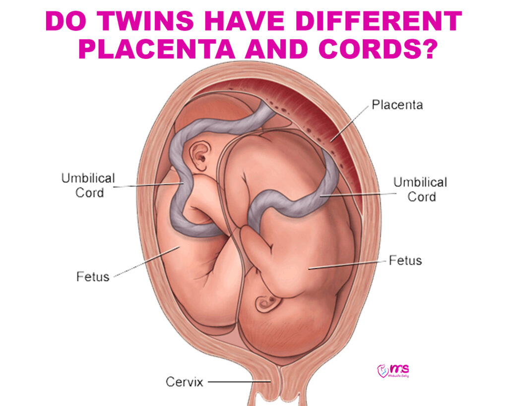 DO TWINS HAVE DIFFERENT PLACENTA AND CORDS?