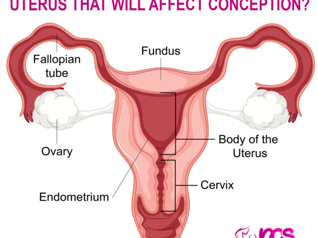 CAN THERE BE ISSUES WITH YOUR UTERUS THAT WILL AFFECT CONCEPTION?