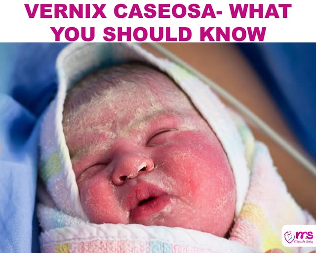 VERNIX CASEOSA- WHAT YOU SHOULD KNOW