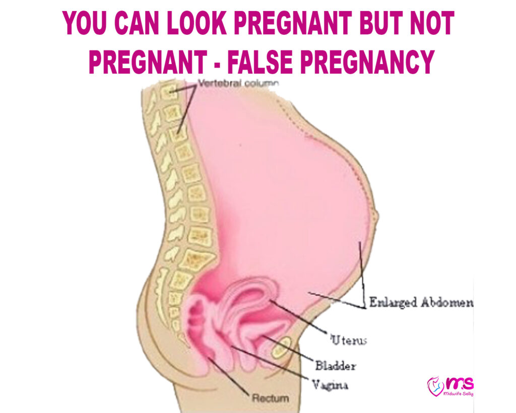 FALSE PREGNANCY