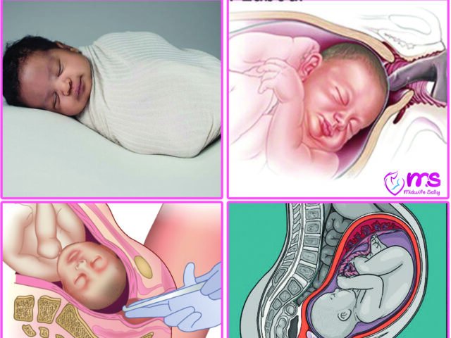 MY BIRTH STORY – INDUCTION OF LABOR WENT WELL