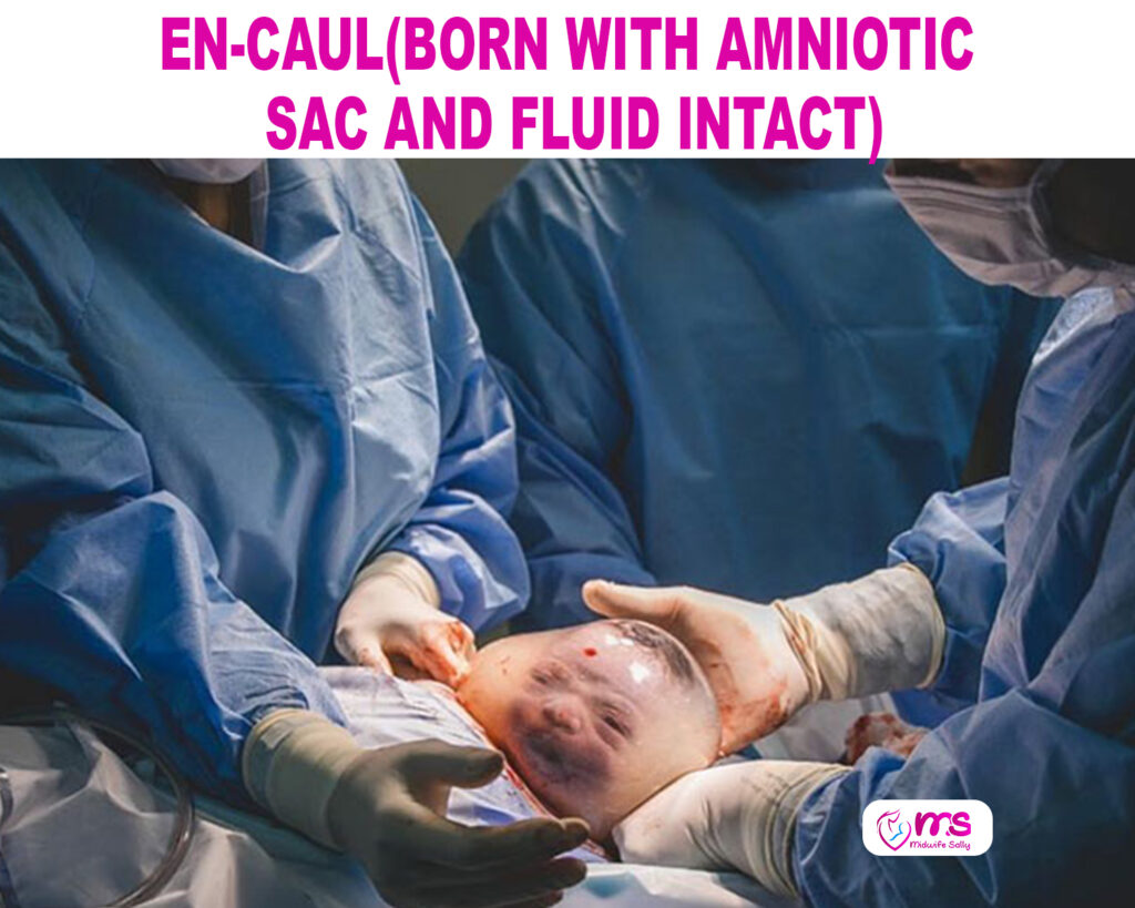 EN-CAUL(BORN WITH AMNIOTIC SAC AND FLUID INTACT)