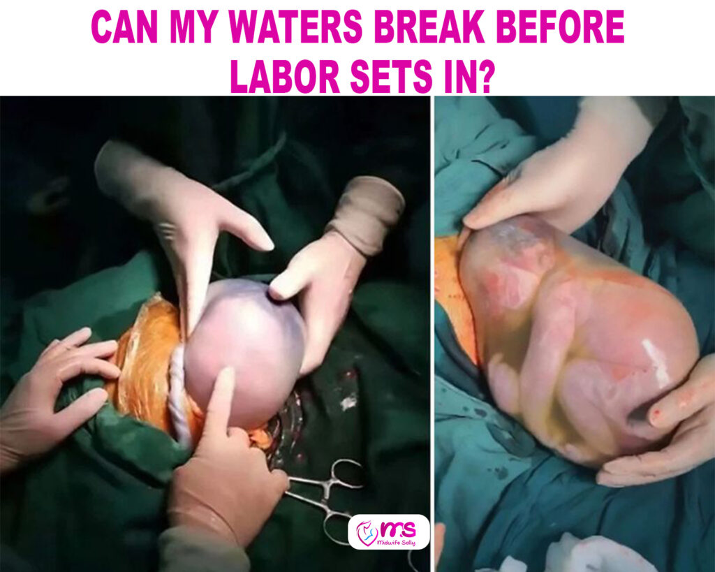 CAN MY WATERS BREAK BEFORE LABOR SETS IN?