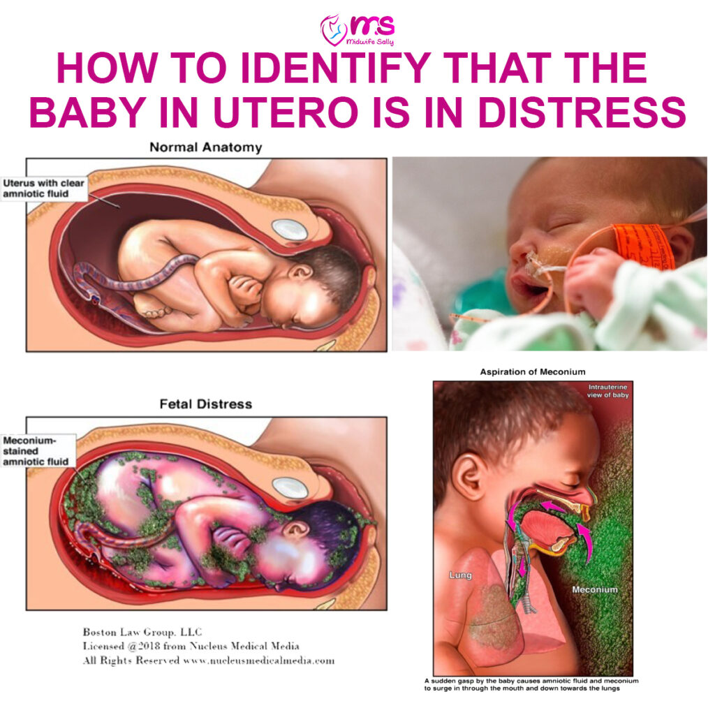 HOW TO IDENTIFY THAT THE BABY IN UTERO IS IN DISTRESS