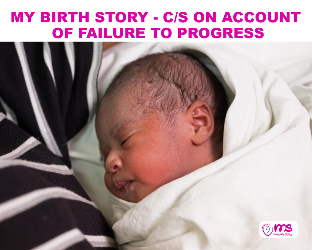 MY BIRTH STORY – C/S ON ACCOUNT OF FAILURE TO PROGRESS