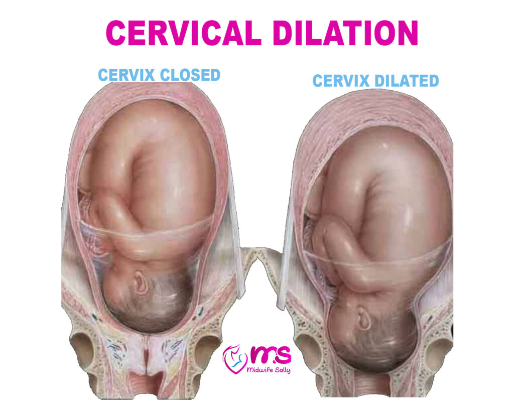 CERVICAL DILATION