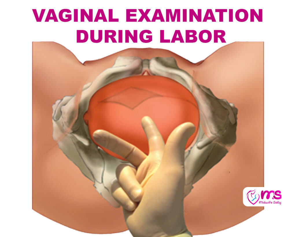 VAGINAL EXAMINATION DURING LABOR