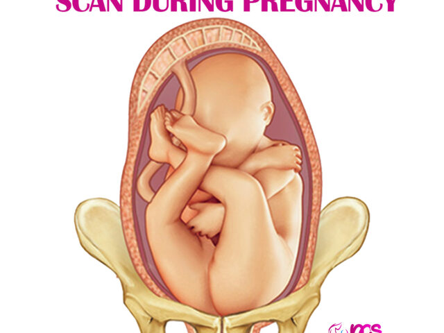 ANOMALY SCAN- AN IMPORTANT SCAN DURING PREGNANCY