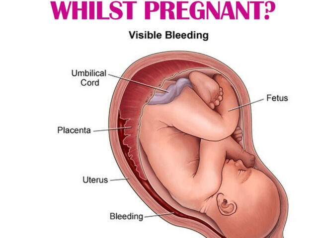 CAN I BE MENSTRUATING WHILST PREGNANT?