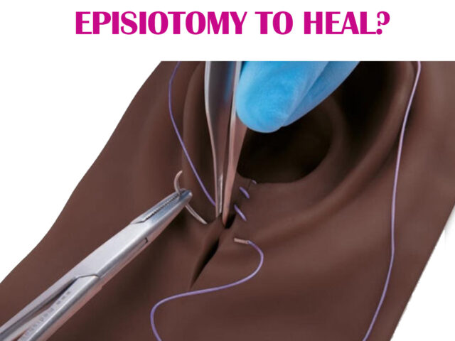 HOW LONG DOES IT TAKE FOR EPISIOTOMY TO HEAL?