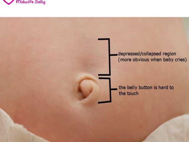 BELLY BUTTON PAIN/DISCOMFORT DURING PREGNANCY